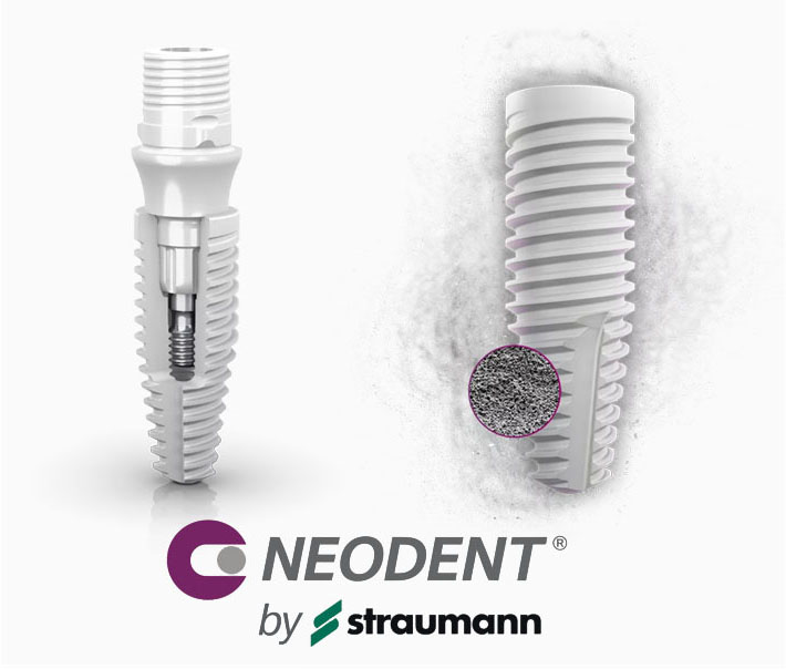 Straumann implantai